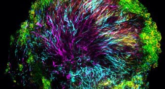 Chicago Microbiome Conference